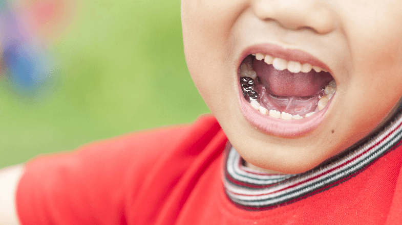 5 benefits of kids dental crowns