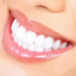 Options for Replacing Missing Teeth
