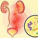 What Factors Contribute to Urinary Tract Infections