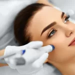5 Benefits of Skin Laser Resurfacing