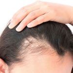 Telltale Signs to See a Hair Loss Specialist