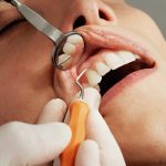 Ways of Treating Dental Pain