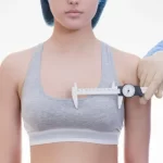 Everything You Need to Know About A Breast Lift