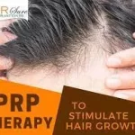 Reasons For Opting for PRP Hair Restoration