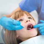 Why Tooth-Colored Fillings for Kids Are Worth Considering